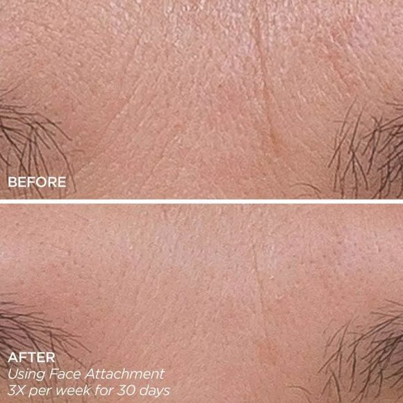 BeautyBio GloPro Microneedling Tool Set - Picture 2 of 3